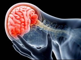 Innovative program helps B.C. patients with overdose related brain injuries