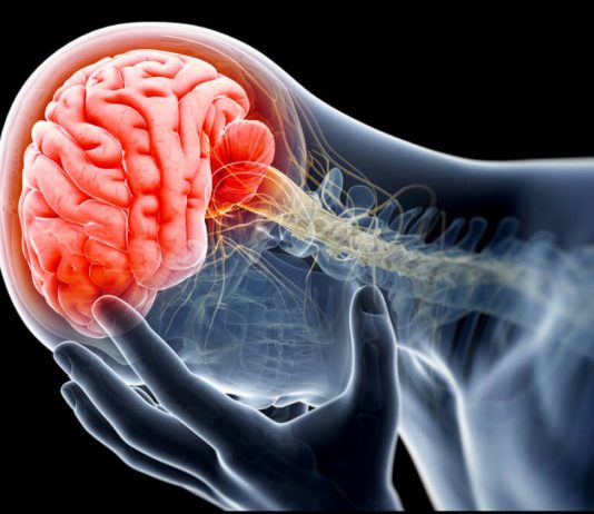 Innovative program helps B.C. patients with overdose related brain injuries